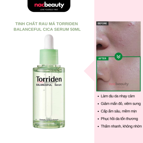 Tinh Chất Torriden Rau Má Làm Dịu Da, Hỗ Trợ Giảm Mẩn Đỏ Cho Da Torriden Balanceful Cica Serum 50ml