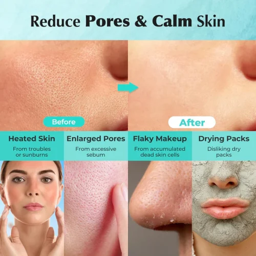 Mặt Nạ Đất Sét Aperire Thu Nhỏ Lỗ Chân Lông, Điều Tiết Dầu Thừa Spa Relief Be Frozen Pore Mask 200g - Ảnh 5