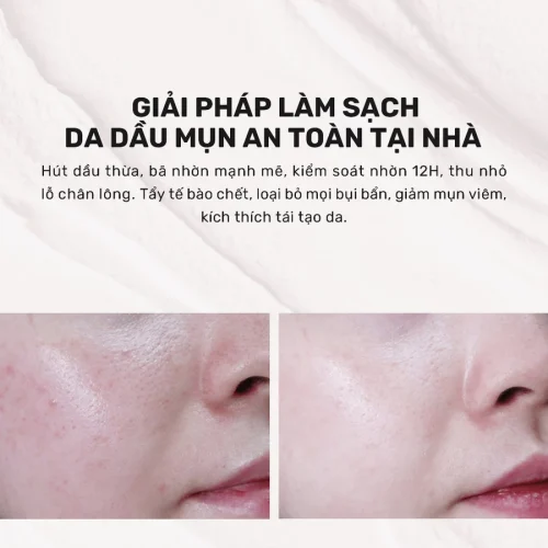 Alternative view of Mặt Nạ Đất Sét Hút Dầu Kiểm Soát Nhờn - Derladie Vegan Pink Clay Mask Deep Pore Tightening 60g/120g